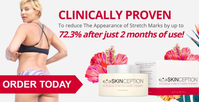 Skinception Intensive Stretch Mark Theapy Cream